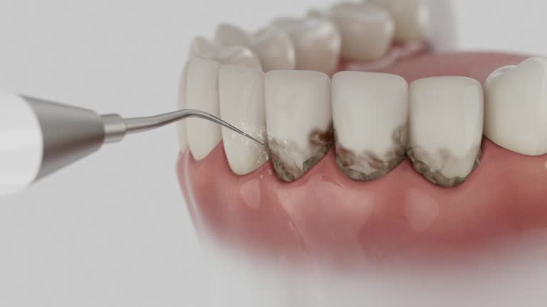 Reliable Dental contractor in Jefferson, WI by Smile Center Dentistry